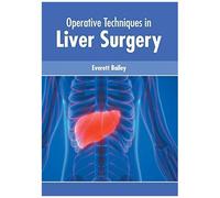 Operative Techniques In Liver Surgery