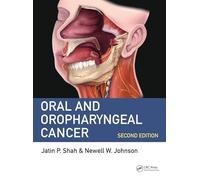 Oral and Oropharyngeal Cancer