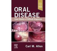 Oral Disease: Case Studies of Difficult Diagnoses: Case Studies of Difficult Diagnoses