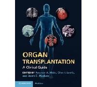 Organ Transplantation: A Clinical Guide