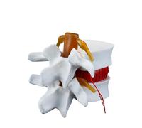 Orivin Modèle anatomique vertébral lombaire - Modèle de démonstration de hernie discale lombaire humaine 1,5X (blanc)