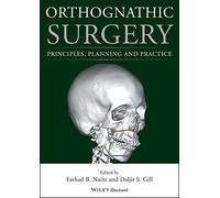 Orthognathic Surgery: Principles, Planning and Practice