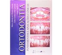 Ortodontia. Fundamentos E Aplicações Clínicas Marco Almeida (Auteur)
