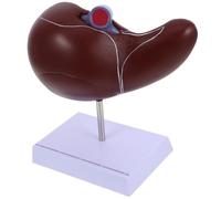 OSOLADY Modèle avec Base pour Enseignement et Affichage Anatomique Foie Réaliste en Plastique Foie Vésicule Biliaire