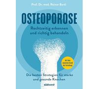Osteoporose rechtzeitig erkennen und behandeln: Die besten Strategien für starke und gesunde Knochen