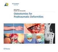 Osteotomies for Posttraumatic Deformities by Ronald J. van Heerwaarden Arthur Schaub, Ronald J. van Heerwaarden (Auteur)