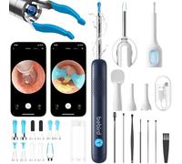 Otoscope Cure Oreille Nettoyage Camera et Lumière, Kit d'Élimination de Cérumen (Cure-oreille, Pince à Cérumen, Goutteur) & Scope de Contrôle ORL pour Usage Domestique