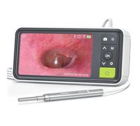 Otoscope numérique 1080p avec gyroscope, caméra AnyScope 3,9 mm avec 6 lumières, écran de 4,5", outil de retrait de cérumen, carte de 32 Go, prend en charge l'enregistrement photo et vidéo