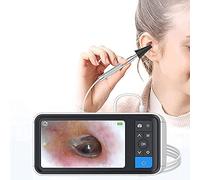 Otoscope numérique avec écran de 4,5 pouces et 6 lumières LED - Caméra auriculaire rechargeable pour adultes, enfants et animaux domestiques