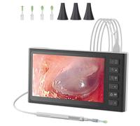 Otoscope numérique avec écran IPS de 7 pouces, caméra outil d'élimination du cérumen de 3,9 mm avec 6 lumières LED, caméra auriculaire visuelle et dissolvant de cérumen, prend en charge la prise de ph