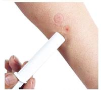 Outil D'aspiration Pour Piqûres D'abeilles Et De Moustiques - Trousse De Premiers Secours Pour Piqûres D'insectes, Morsures De Serpents, Secours D'urgence Portable