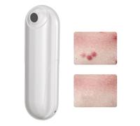 Outil De Soulagement Des DéMangeaisons Des PiqûRes D'insectes, Ventouse De Moustique Rechargeable Par Usb, Sans Produits Chimiques Pour Les PiqûRes D'insectes, Les PiqûRes De GuêPes D'abeilles