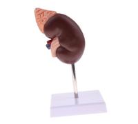 Outil éducatif D'anatomie du Modèle Rénal pour l'enseignement Médical et Les Cours de santé, 24 Marqueurs, PVC