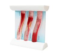 Outil pédagogique de modèle vasculaire éducatif avec formation de plaques visibles et simulation réaliste des systèmes circulatoires Démonstration réaliste du flux sanguin