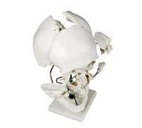 Outils de modèle pédagogique, modèle de crâne humain 17 pièces, modèle de séparation des os du crâne, pièces du crâne humain, modèle d'anatomie, modèle d'enseignement, crâne adulte séparé, modèle 30