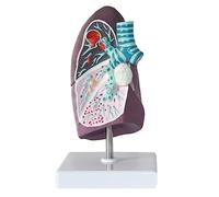 Outils Pédagogiques Modèle de Cancer du Poumon 2:3 Modèle Anatomie Pulmonaire Humaine avec Caractéristiques Pathologiques Texture Claire Et Structure Anatomique Précise pour Les Études Et La Reche
