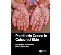 Paediatric Cases in Coloured Skin by Kannangara & Ajith P. Teaching Hospital Karapitiya & Sri Lanka Kannangara Ajith P. Teaching Hospital Karapitiya Sri Lanka (Auteur)