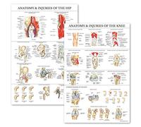 Palace Learning Lot de 2 posters anatomiques et blessures du genou et de la hanche - Ensemble de tableaux anatomiques - Laminé 45,7 x 61 cm