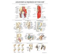 Palace Learning Poster plastifié Anatomie et blessures de la hanche - Tableau anatomique de l'articulation de la hanche - 45,7 x 61 cm