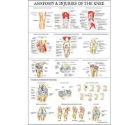 Palace Learning Poster plastifié Anatomie et blessures du genou - Tableau anatomique de l'articulation du genou - 45,7 x 61 cm