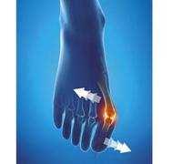 Parapharmacie en ligne > Matériel Médical > Orthopédie Epitact Hallux Valgus Oignon Orthèse Corrective de Nuit - Orthopédie - Pharmacie en ligne LaSante.netM