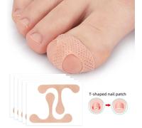 Patchs Correcteurs D'orteils, Bandage De Correction Des Ongles Incarnés