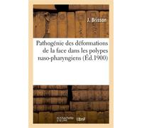 Pathogénie des déformations de la face dans les polypes naso-pharyngiens - Brisson-J - Hachette Bnf - broché - Livre