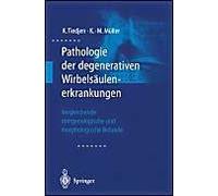 Pathologie Der Degenerativen Wirbelsäulenerkrankungen