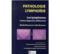 PATHOLOGIE LYMPHOIDE - LES LYMPHOMES ET LEURSDIAGNOCTICS DIFFERENTIELS