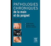 Pathologies chroniques de la main et du poignet: Tome 2