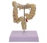 Pathologies humaines du gros intestin Modèle d'enseignement médical Outil d'enseignement du gros intestin Anatomie du gros intestin Modèle humain