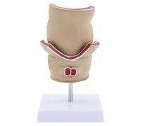 Pathologies humaines du modèle rectum Rectum Outil pédagogique médical facile à utiliser Modèle anatomique rectal humain pour l'anatomie