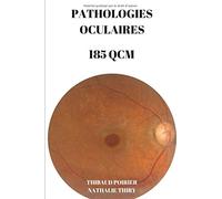 PATHOLOGIES OCULAIRES 185 QCM