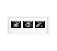 Pearhead Cadre Trimester Sonogram, Deluxe