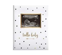 Pearhead Hello Baby Baby Memory Book, Milestone Journal, New Mum Gift, Newborn Baby, Thoughtful Keepsake for Christening or Baptism, Black and White Polka Dot, UK English Version