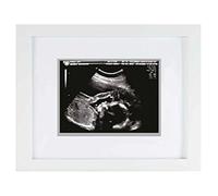 Pearhead Sonogram Frame, Gender-Neutral Pregnancy Announcement Picture Frame, Ultrasound Keepsake Photo Frame, Nursery Décor, White