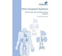 Pelvic Congestion Syndrome - Chronic Pelvic Pain and Pelvic Venous Disorders