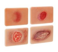 PER4MANCE Modèle d'ulcère de pression stades I - IV : kit d'entraînement en silicone pour la pratique infirmière et l'éducation médicale