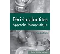 Péri-Implantites - Approche Thérapeutique