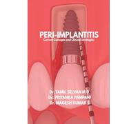 Peri-Implantitis: Current Concepts and Clinical Strategies