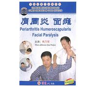 Periarthritis Humeroscapularis Facial Paralysis