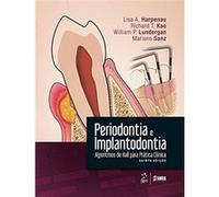 Periodontia E Implantodontia. Algoritmos De Hall Para Prática Clínica Lisa A Harpenau (Auteur)