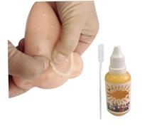 Pesoncarl Jouet Fidget, Pimple pops Jouet compresser acné Jouets Nez Bouton de Stress Jouet Stress Relief newety Jouet avec Solution additive de 30 ML