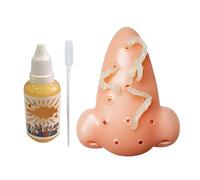 Pesoncarl Pimple pops Jouet compreindre l'acné Jouets Nez Nez Pimple de Stress Stress Relief nouveauté avec Une Solution additive de 30 ML, Toys compresser
