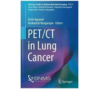 Pet/Ct In Lung Cancer