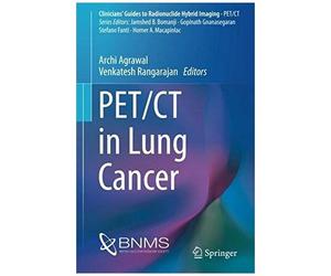 Pet/Ct In Lung Cancer