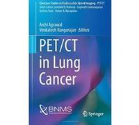 PET/CT in Lung Cancer (Cliniciansâ€™ Guides to Radionuclide Hybrid Imaging) - [Livre en VO] Archi Agrawal, Venkatesh Rangarajan (Auteur)