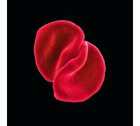 Peter Gabriel – Scratch My Back