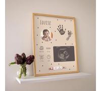 Petit Artichaut Cadre souvenir de naissance de bébé - Cadre souvenir de nouveau-né avec photo, échographie et bracelet d'hôpital, kit d'empreintes de mains et de pieds de bébé avec encre sans contact