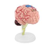 Pissente Modèle Anatomique de Cerveau Humain, Outil d'enseignement, Pièces Démontées avec Base Robuste pour l'étude de la Neurologie, éducation des Patients